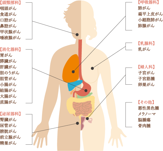 過去治療したがん種のイメージ画像