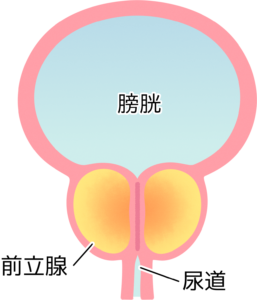 前立腺がん・ステージ4の余命