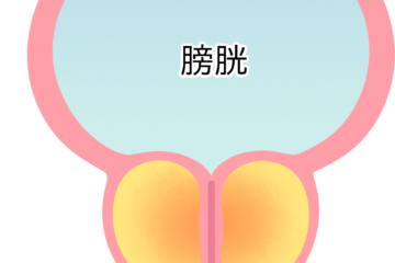 「前立腺がんの余命とは？症状や治療法、ステージ4の生存率についても解説」記事内の画像