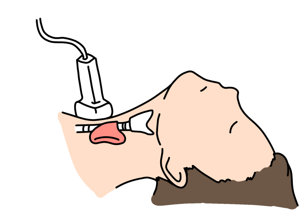 甲状腺がんの検査方法