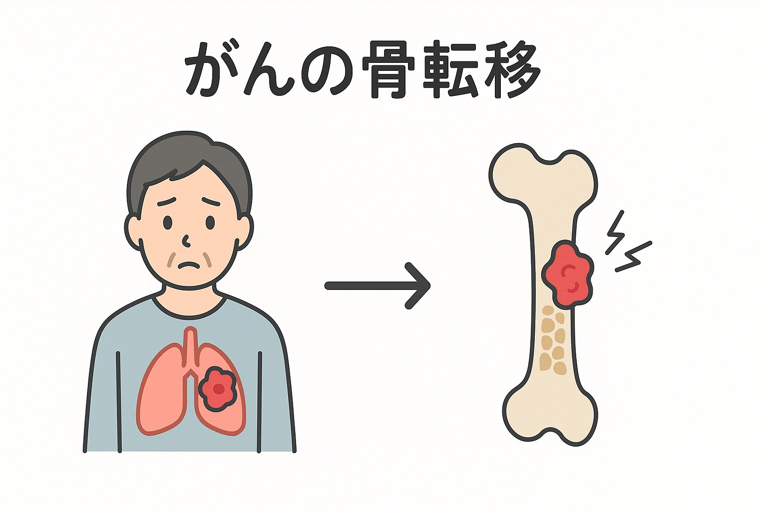 骨転移の痛みとは?原因・症状・治療法まで徹底解説|しびれや骨折も注意 | がん免疫療法コラム | 一般社団法人同仁会 同仁クリニック