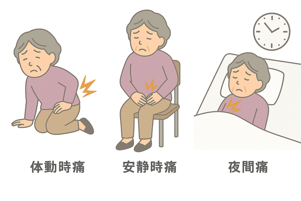 骨転移による「痛み」とは？その特徴と原因