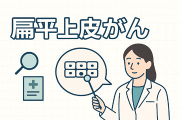 「扁平上皮がんのステージ4とは？余命や生存率、症状、転移、治療法について解説」記事内の画像