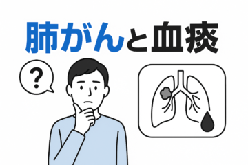 「肺がんと血痰について｜他の病気の血痰との違い、受けるべき検査や治療法など解説」記事内の画像