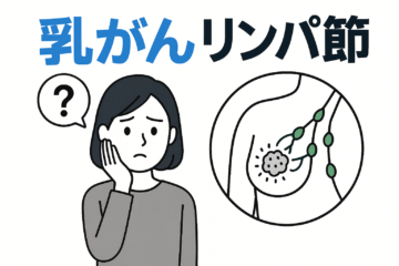 「乳がんのリンパ節転移とは？余命や生存率、ステージや症状、治療法など解説」記事内の画像