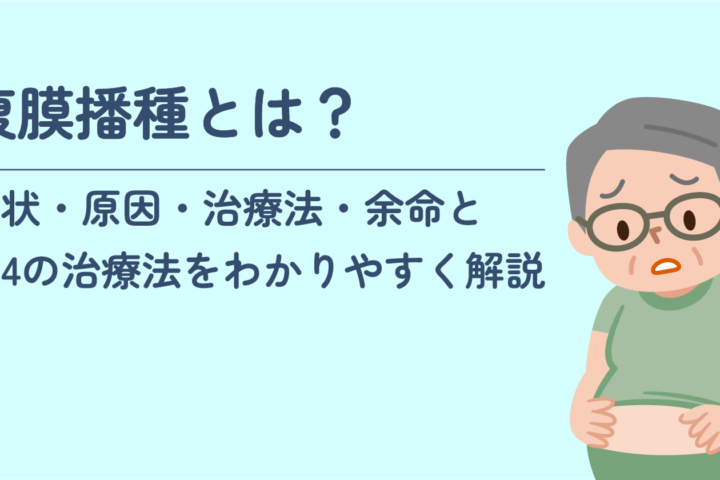 「腹膜播種とは？症状・原因・治療法・余命と第4の治療法をわかりやすく解説。」記事内の画像