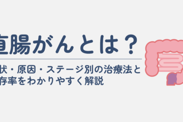 「直腸がんとは？症状・原因・ステージ別の治療法と生存率をわかりやすく解説」記事内の画像